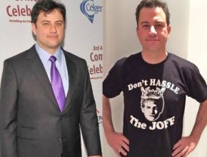 Jimmy Kimmel before and after plastic surgery (19)