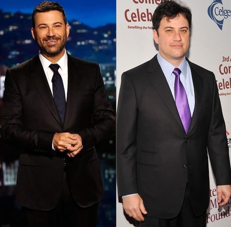Jimmy Kimmel before and after plastic surgery