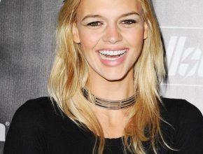 Kelly Rohrbach plastic surgery (1)