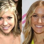 Kristin Cavallari plastic surgery (57)