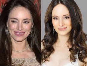 Madeleine Stowe before and after plastic surgery (1)