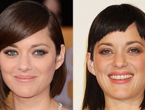 Marion Cotillard before and after plastic surgery