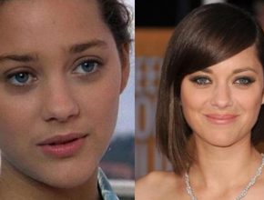 Marion Cotillard before and after plastic surgery (28)