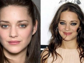Marion Cotillard before and after plastic surgery (29)