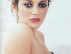 MarionCotillard plastic surgery (1)