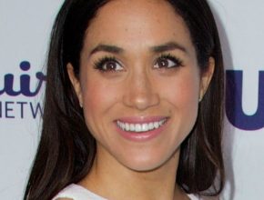 Meghan Markle plastic surgery