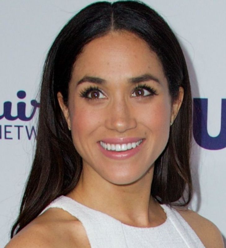 Meghan Markle plastic surgery