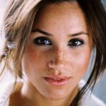 Meghan Markle plastic surgery (29)