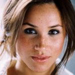 Meghan Markle plastic surgery (32)