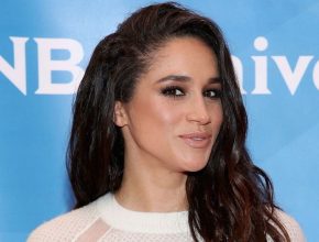 Meghan Markle plastic surgery (49)