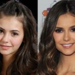 Nina Dobrev before and after plastic surgery (21)