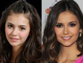 Nina Dobrev before and after plastic surgery (21)