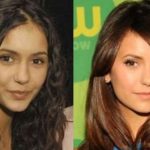 Nina Dobrev before and after plastic surgery (26)