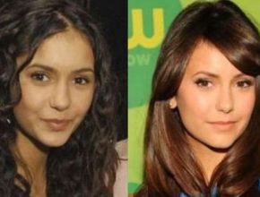 Nina Dobrev before and after plastic surgery (26)