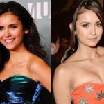 Nina Dobrev before and after plastic surgery (28)