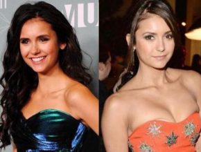 Nina Dobrev before and after plastic surgery (28)