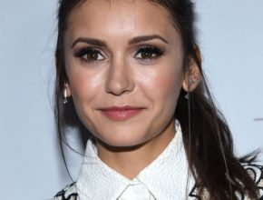 Nina Dobrev plastic surgery (17)