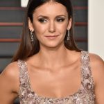 Nina Dobrev plastic surgery (20)