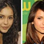 Nina Dobrev plastic surgery (26)