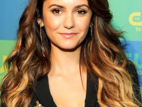 Nina Dobrev plastic surgery (43)
