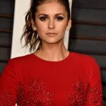 Nina Dobrev plastic surgery (6)