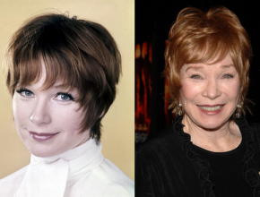 Shirley MacLaine before and after plastic surgery