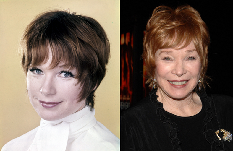 Shirley MacLaine before and after plastic surgery