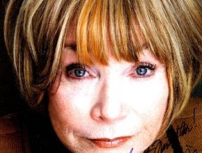 Shirley MacLaine plastic surgery (28)