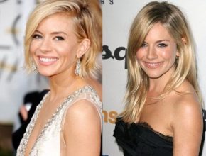 Sienna Miller before and after plastic surgery