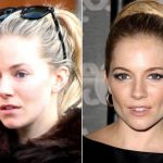 Sienna Miller before and after plastic surgery (26)