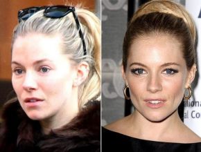 Sienna Miller before and after plastic surgery (26)