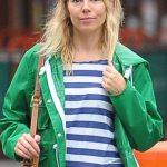 Sienna Miller plastic surgery (18)