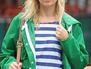 Sienna Miller plastic surgery (18)