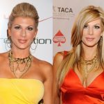 Alexis Bellino before and after plastic surgery (1)