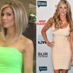 Alexis Bellino before and after plastic surgery