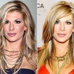 Alexis Bellino before and after plastic surgery (17)