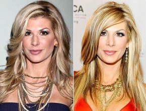 Alexis Bellino before and after plastic surgery (17)