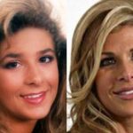 Alexis Bellino before and after plastic surgery (20)