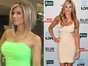 Alexis Bellino before and after plastic surgery