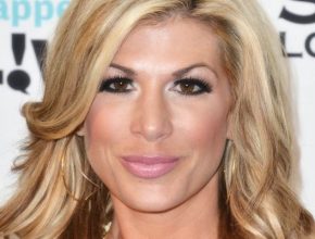 Alexis Bellino plastic surgery (21)