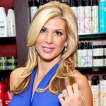 Alexis Bellino plastic surgery (24)