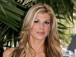 Alexis Bellino plastic surgery (48)