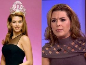 Alicia Machado before and after plastic surgery