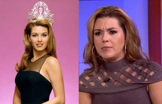 Alicia Machado before and after plastic surgery