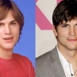 Ashton Kutcher before and after plastic surgery (19)