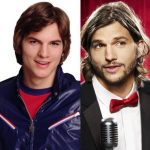 Ashton Kutcher before and after plastic surgery (21)