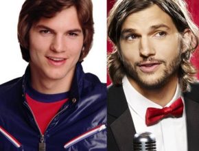 Ashton Kutcher before and after plastic surgery (21)