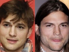 Ashton Kutcher before and after plastic surgery (23)