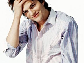 Ashton Kutcher plastic surgery (11)