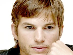Ashton Kutcher plastic surgery (12)
